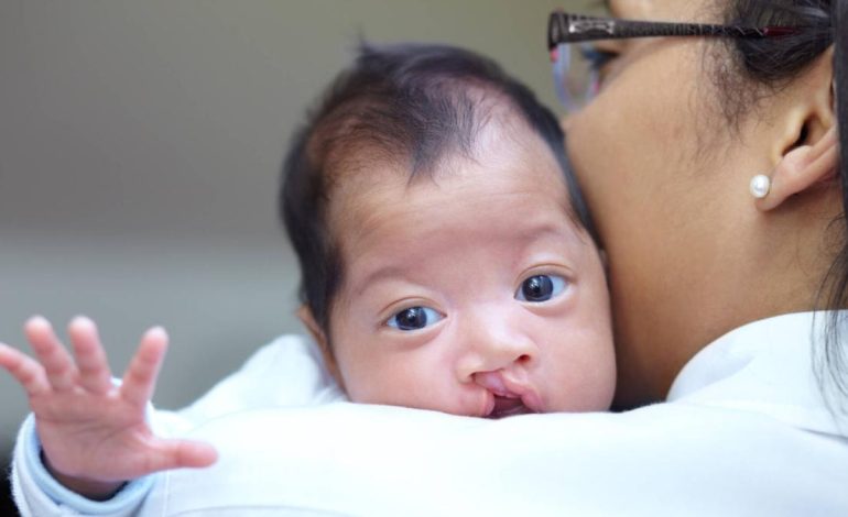 Los médicos especiales llevarán a cabo una cirugía gratuita para niños con labios leporino del 6 al 10 de junio
– Primer plano