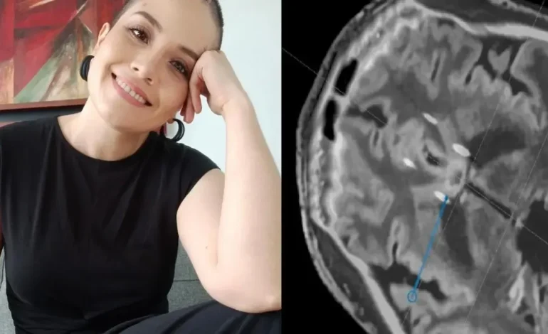 ¿Existe una operación para mejorar la depresión? La historia de una mujer que aprobó el procedimiento cerebral pionero
– Primer plano