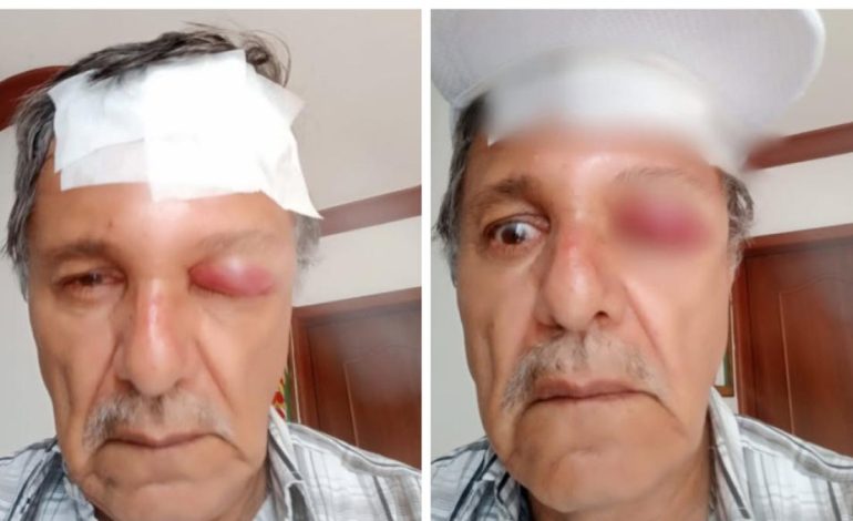 De esta manera, un camarógrafo atacado por un motociclista en Cali
– Primer plano