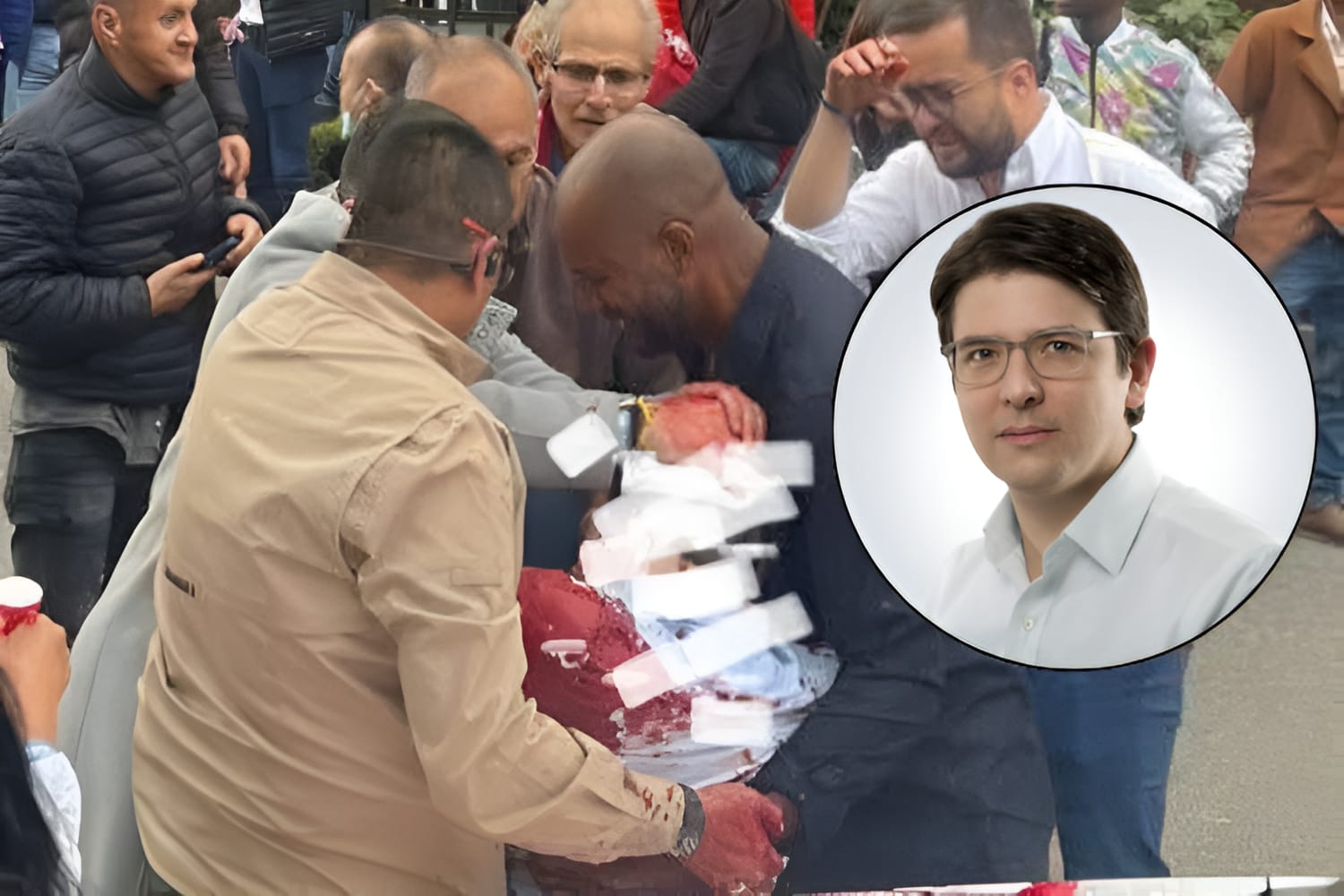 Ataque contra Miguel Uribe Turbay: un año de 15 años le habría disparado al menos seis ocasiones

 – Primer plano