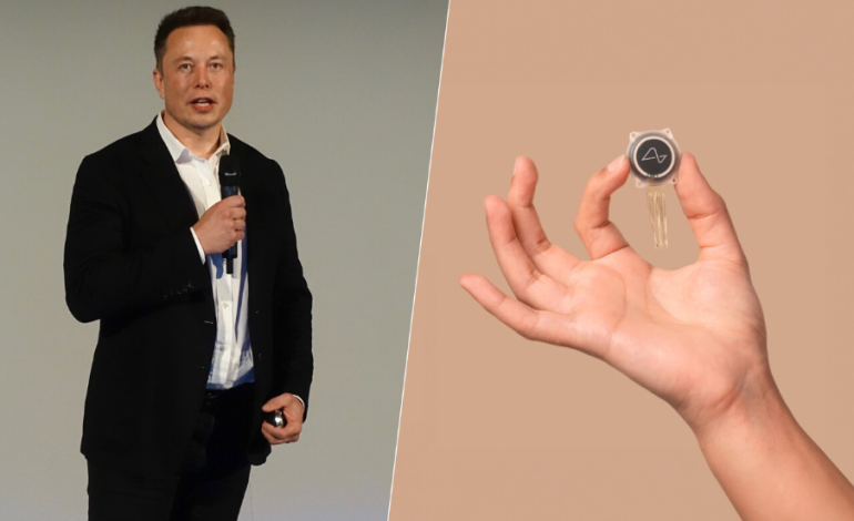 Elon Musk comienza la primera prueba pública de Neuralink en humanos

 – Primer plano