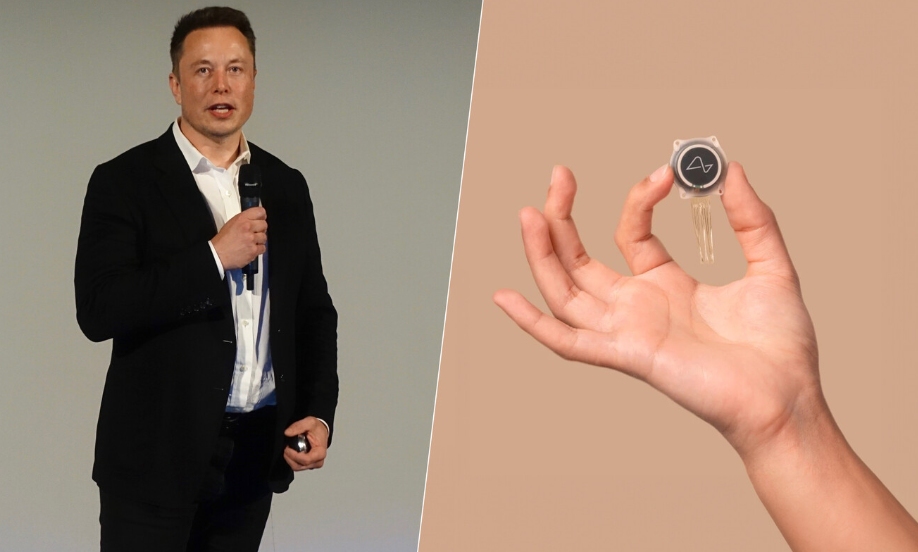 Elon Musk comienza la primera prueba pública de Neuralink en humanos

 – Primer plano