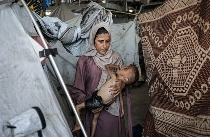 La imagen que paralizó las redes: los niños enfermo palestino abre el debate sobre el hambre en Gaza

 – Primer plano