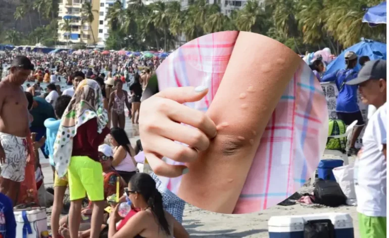 Las colas informan explosiones de la piel después de ingresar al mar en Santa Marta; La mujer afectada le dice su experiencia

 – Primer plano