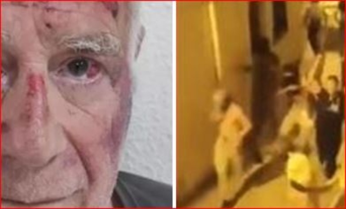 La violencia en Torre Pacheco puede ser un posible desafío viral

 – Primer plano