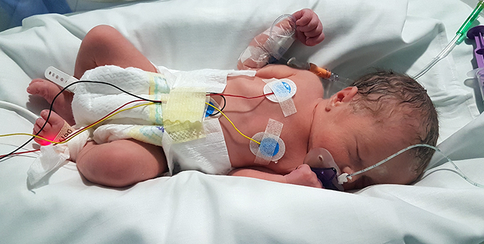 Recién nacidos amigables con bacterias menos resistentes gracias a los probióticos

 – Primer plano