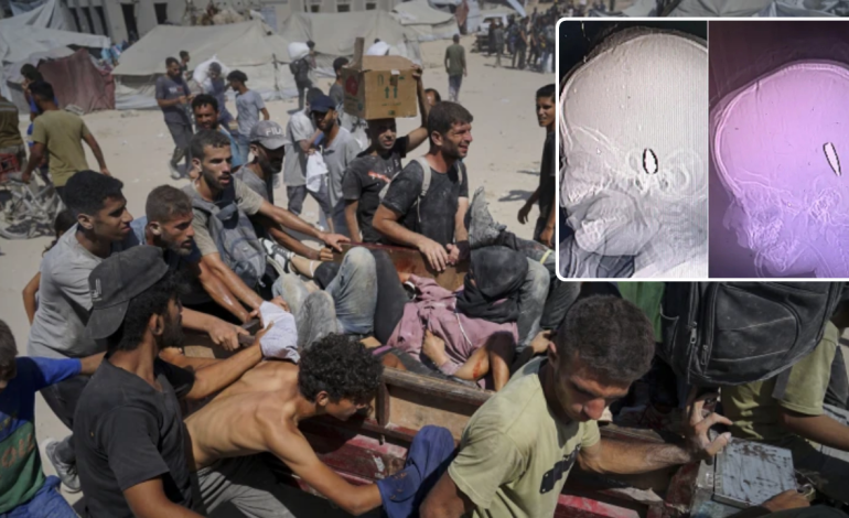 Balled Children in Gaza: BBC Research apunta a los crímenes de guerra
 – Primer plano