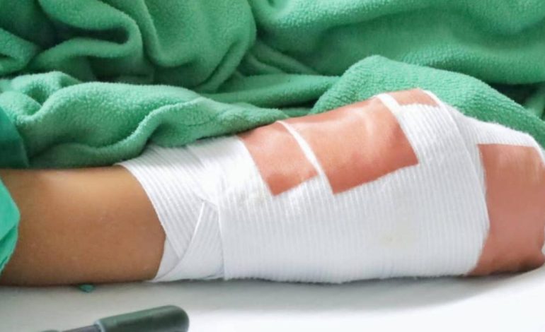 Nuevos detalles de los residentes de la calle, que prendieron fuego a la discusión en Medellín: «Él afirmaba»

 – Primer plano