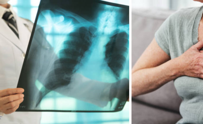 Dadis informa más de 300 casos de tuberculosis hasta 2025.

 – Primer plano