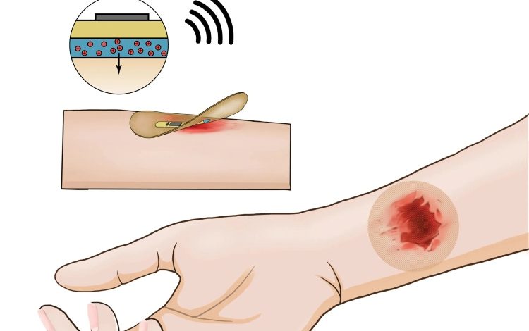 La estimulación eléctrica acelera la curación de heridas, muestra el examen
– Primer plano
