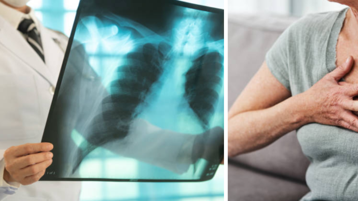 Más de 700 casos se han registrado en la región

 – Primer plano