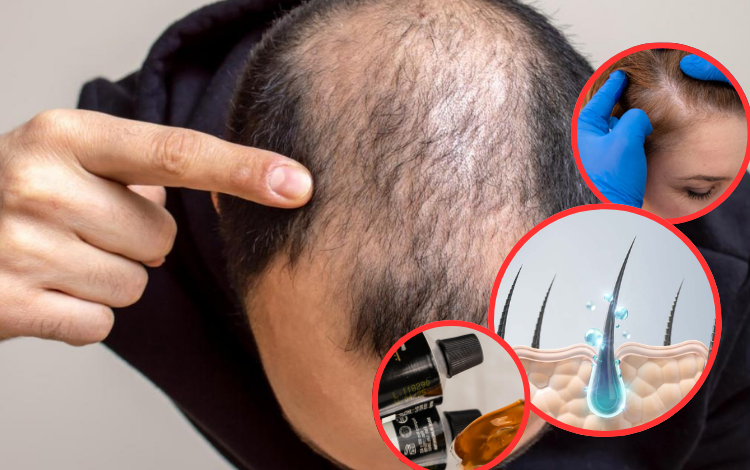 Según un estudio científico, el nuevo gel estimula el crecimiento del cabello hasta en un 90%

 – Primer plano