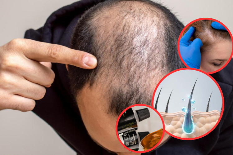 Según un estudio científico, el nuevo gel estimula el crecimiento del cabello hasta en un 90%

 – Primer plano