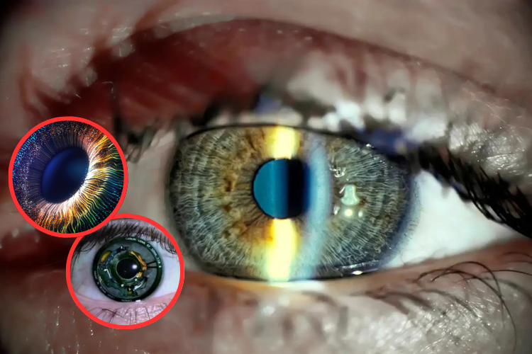 Un revolucionario implante ocular devuelve la vista a los ciegos

 – Primer plano