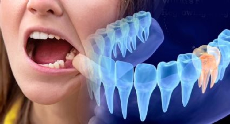 Los científicos en Japón descubren células madre que forman raíces dientes
– Primer plano