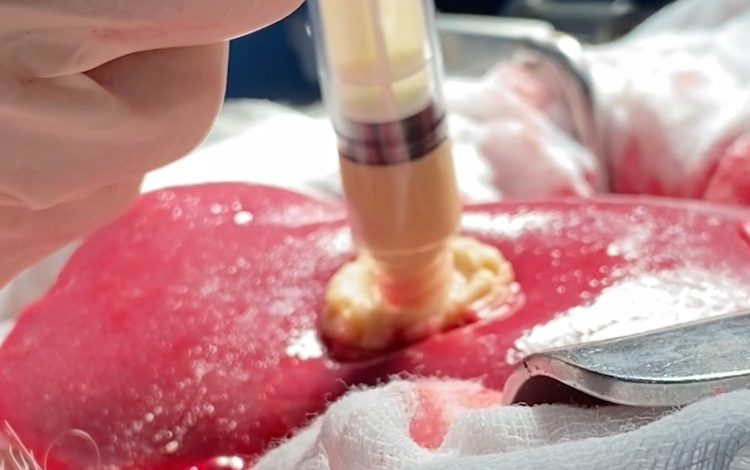 Adolescente crea gel de algas que detiene el sangrado

 – Primer plano