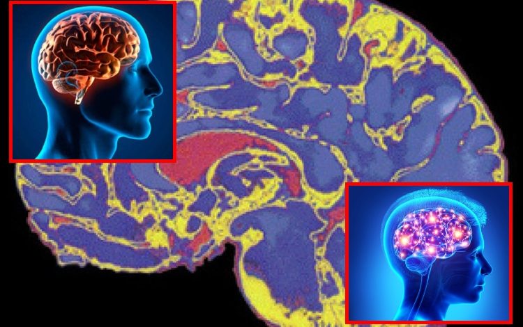 Según el estudio, el cerebro permanece en modo juvenil hasta los 30 años

 – Primer plano