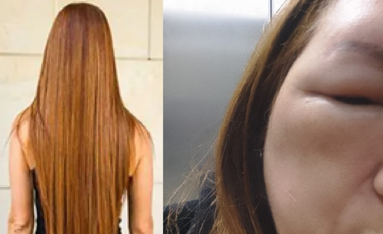 su cráneo y su cara estaban hinchados

 – Primer plano