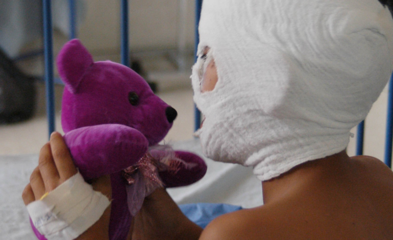 Más de 30 personas sufrieron quemaduras de pólvora en Nariño; Una de las víctimas es un niño de 4 años con heridas faciales y ojos dañados.

 – Primer plano