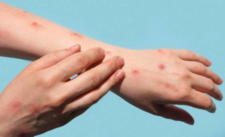 El hecho ocurrió en Barrancabermeja, el paciente se recupera en Bucaramanga

 – Primer plano